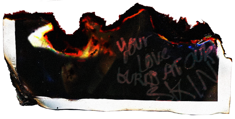 Burn photo